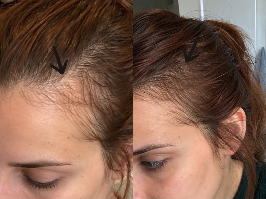 Customer photo review of KosmaHair Sérum | Restaurador Capilar & Entradas