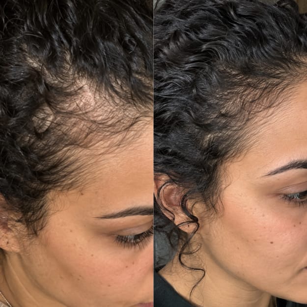 Customer photo review of KosmaHair Sérum | Restaurador Capilar & Entradas