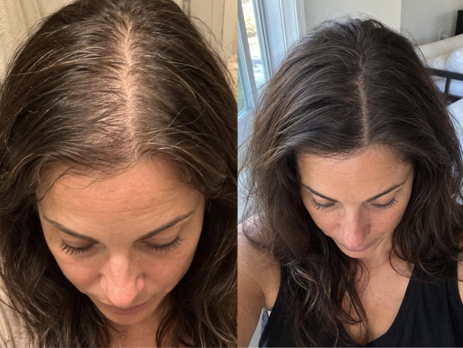 Customer photo review of KosmaHair Sérum | Restaurador Capilar & Entradas