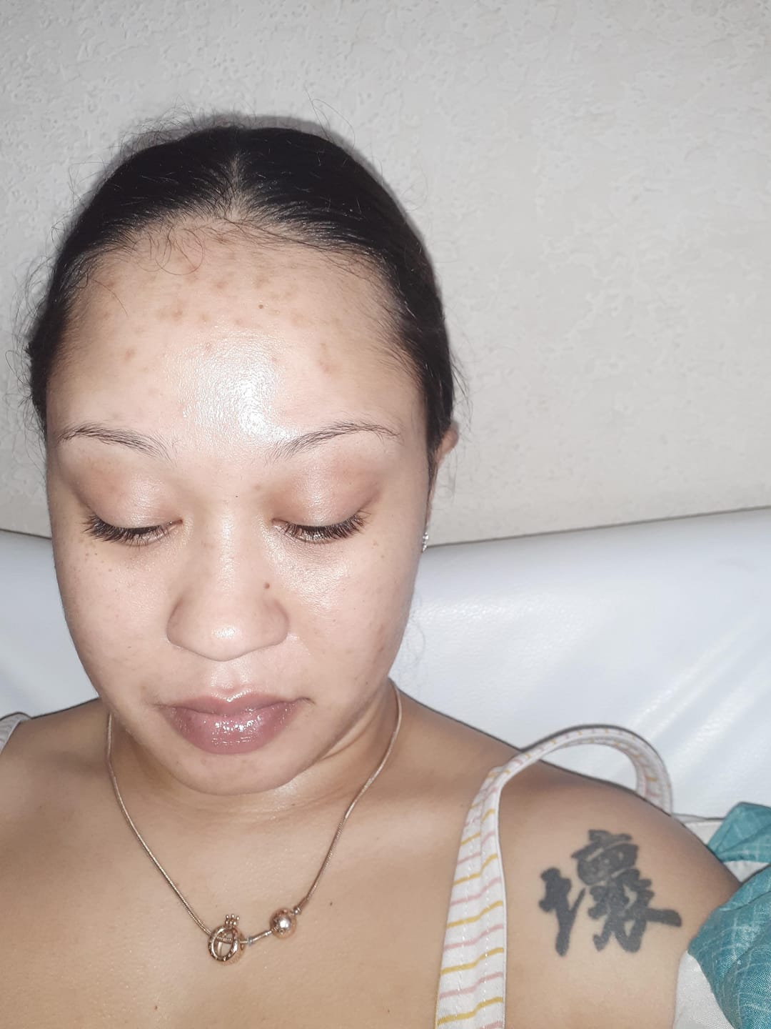 Customer photo review of Exosome & Niacinamide Serum for Radiant, Smoother-Looking Skin
