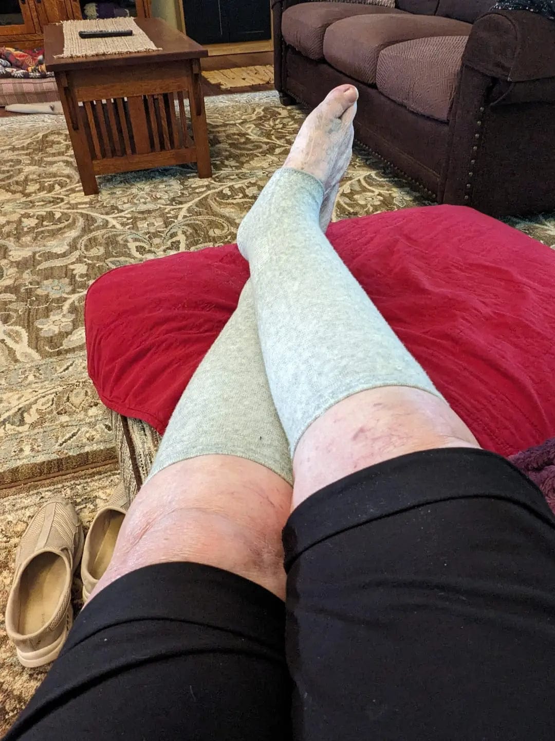 Customer photo review of Piedelya™ – Manchons de compression pour les pieds