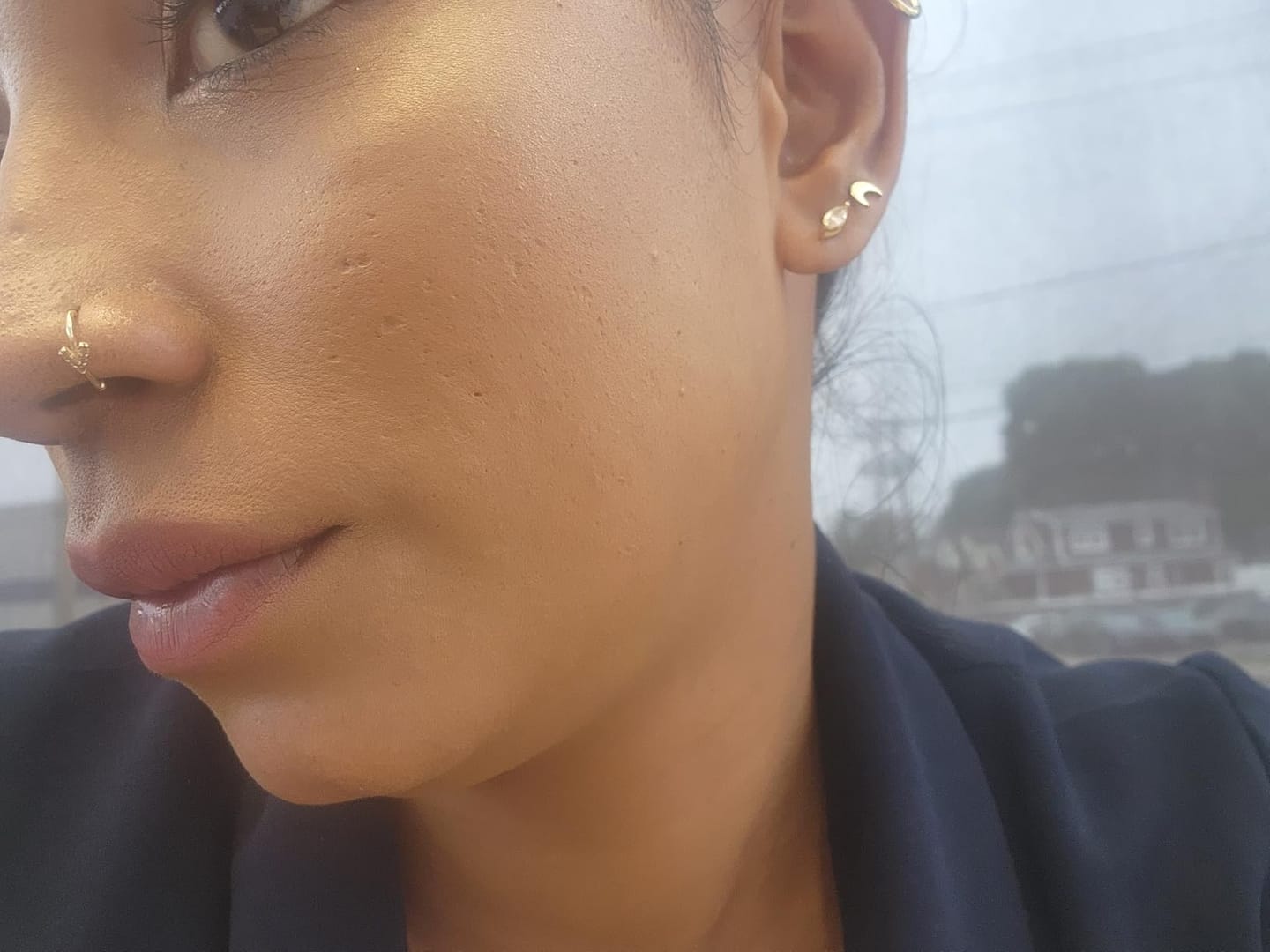 Customer photo review of Exosome & Niacinamide Serum for Radiant, Smoother-Looking Skin