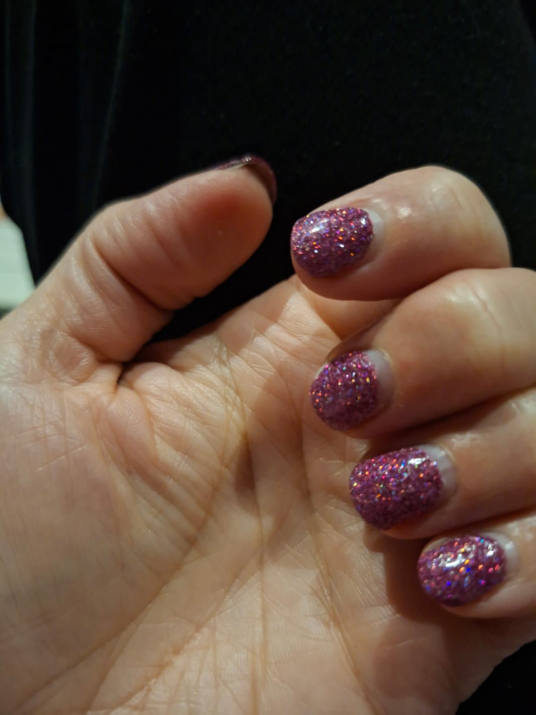 Customer photo review of Verzending Verzekering