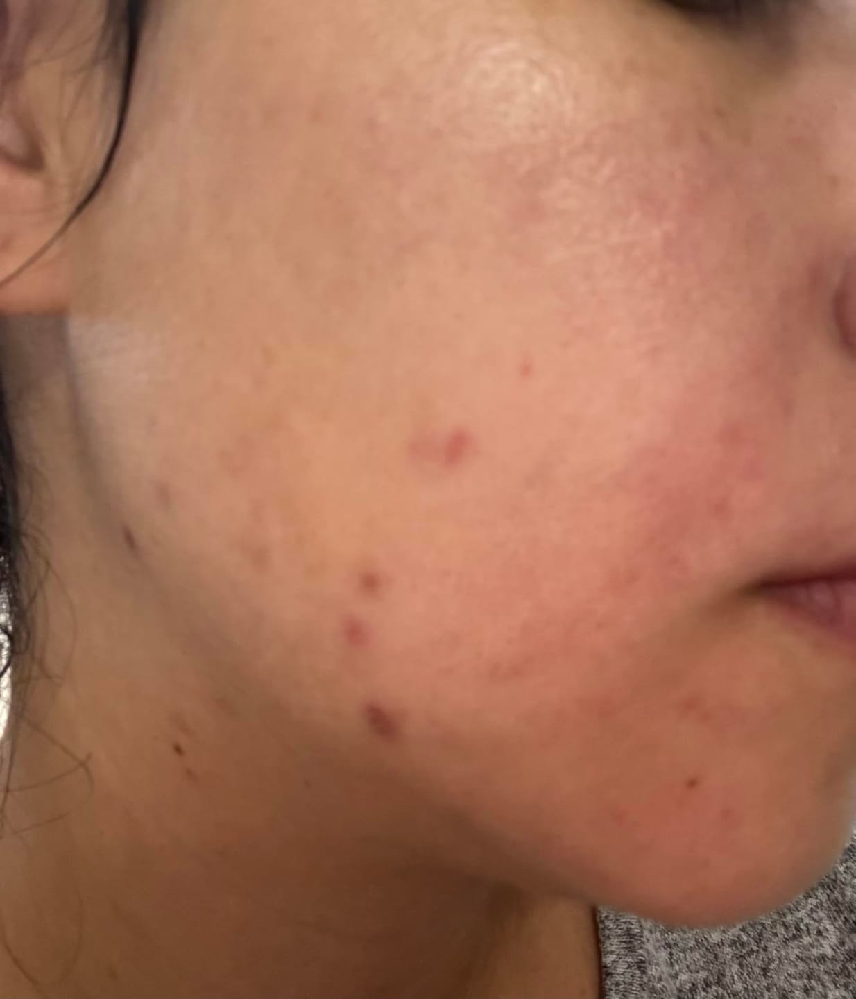 Customer photo review of Exosome & Niacinamide Serum for Radiant, Smoother-Looking Skin