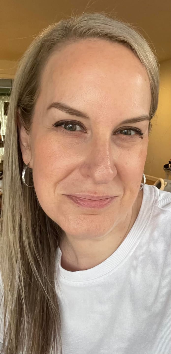 Customer photo review of Exosome & Niacinamide Serum for Radiant, Smoother-Looking Skin