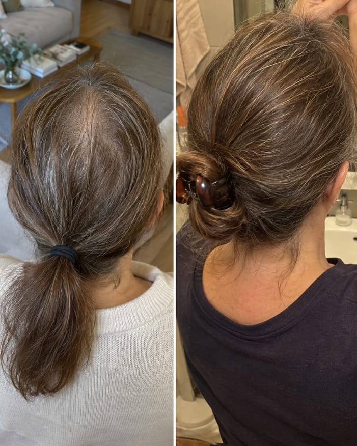 Customer photo review of KosmaHair Sérum | Restaurador Capilar & Entradas