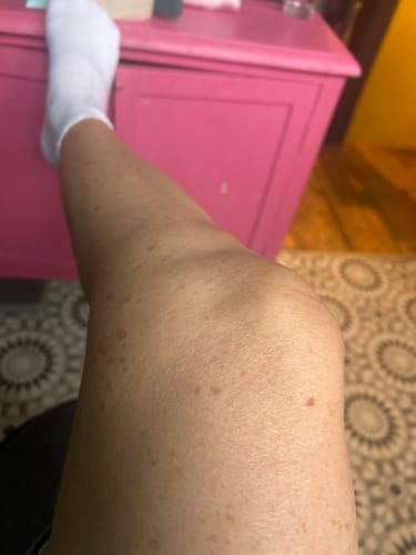 Customer photo review of NØRD BODY Peptide Body Oil