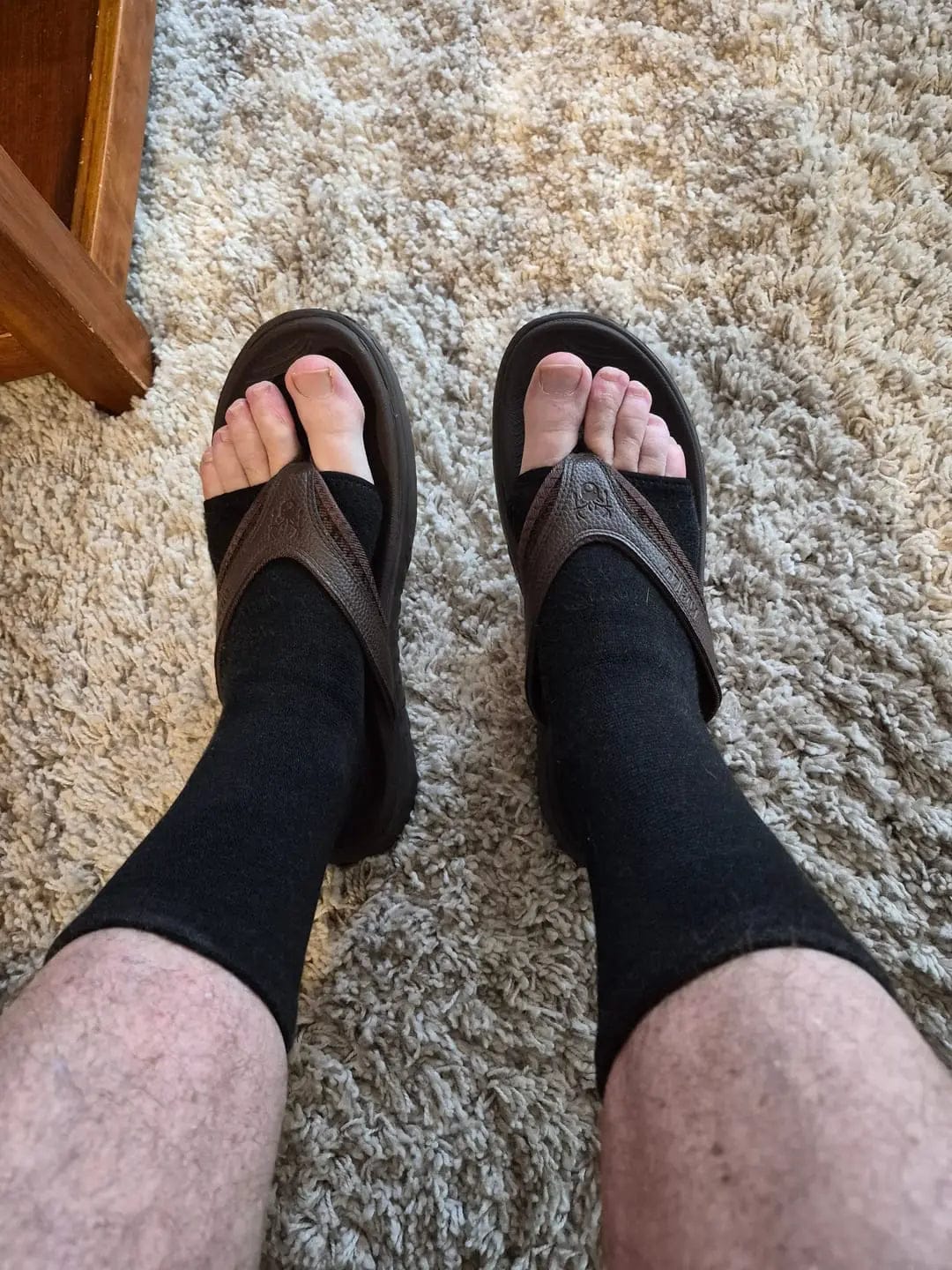 Customer photo review of Piedelya™ – Manchons de compression pour les pieds