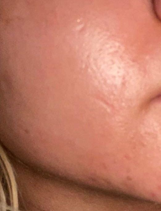 Customer photo review of Exosome & Niacinamide Serum for Radiant, Smoother-Looking Skin