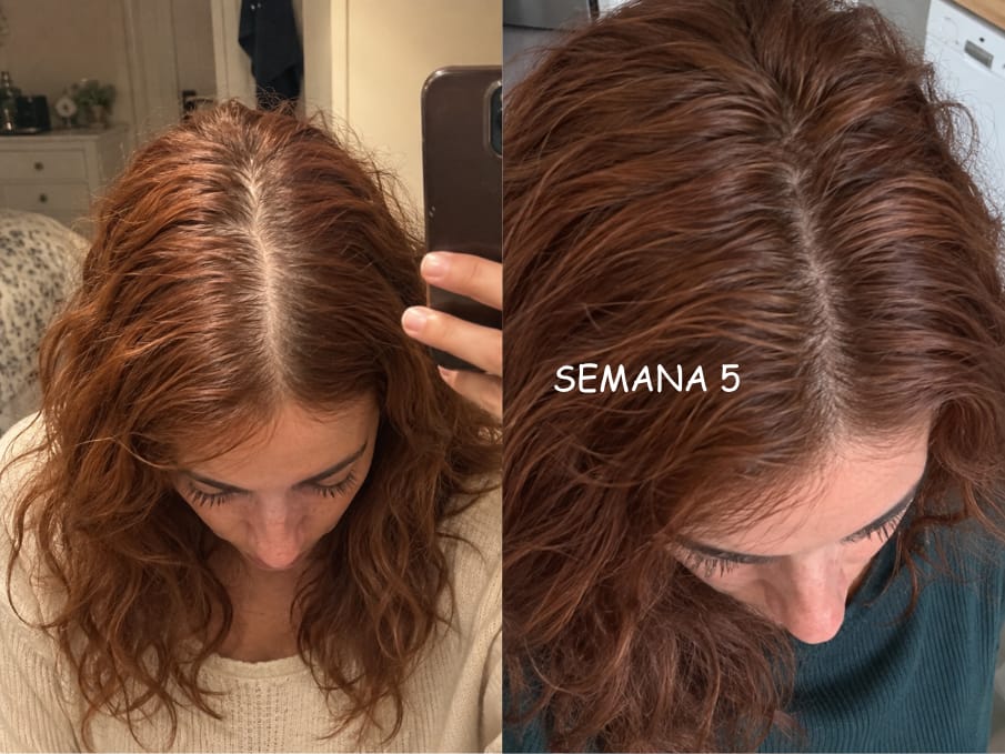 Customer photo review of KosmaHair Sérum | Restaurador Capilar & Entradas