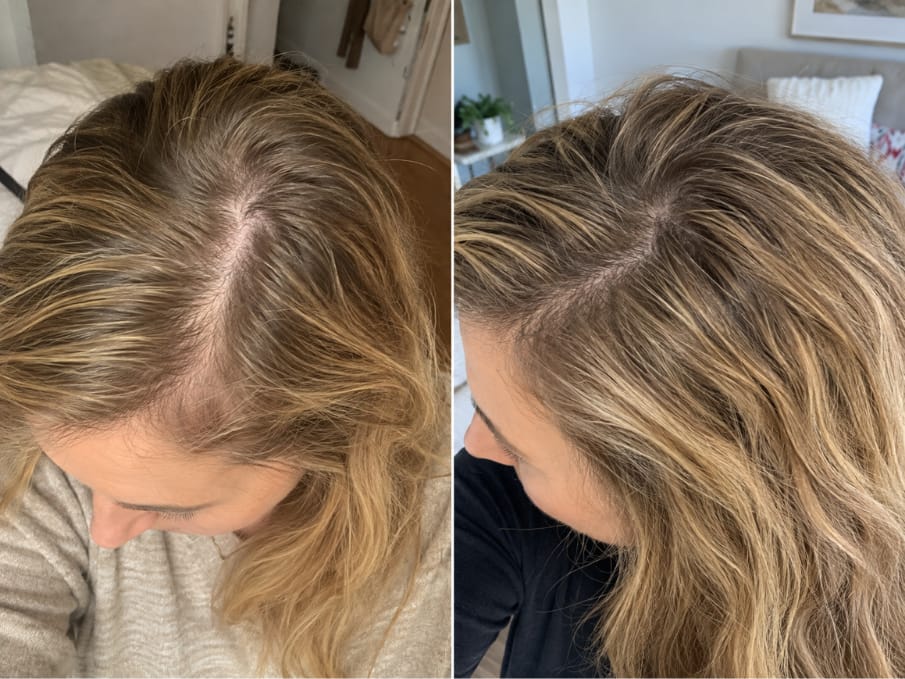 Customer photo review of KosmaHair Sérum | Restaurador Capilar & Entradas