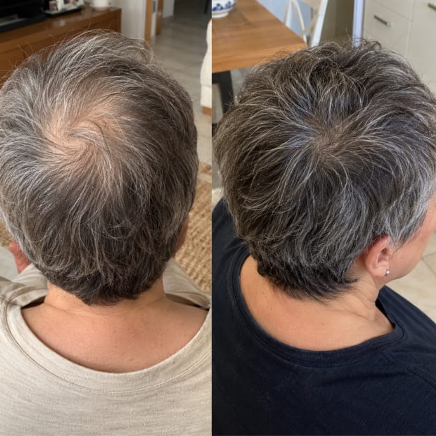 Customer photo review of KosmaHair Sérum | Restaurador Capilar & Entradas