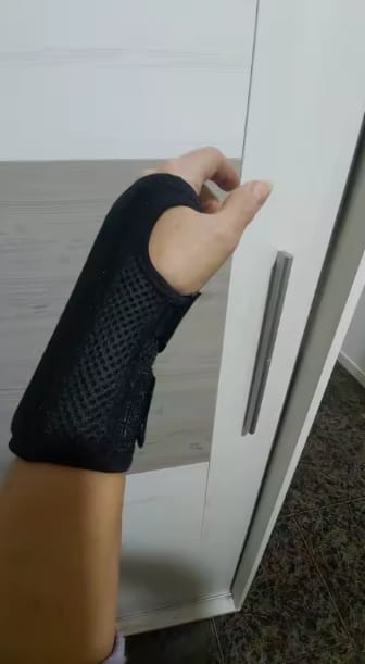Customer photo review of VitaGrip™ Premium Soporte de Compresión para Muñeca