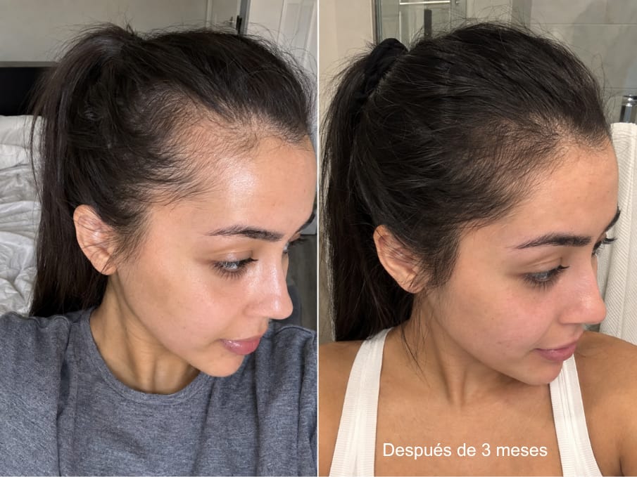 Customer photo review of KosmaHair Sérum | Restaurador Capilar & Entradas