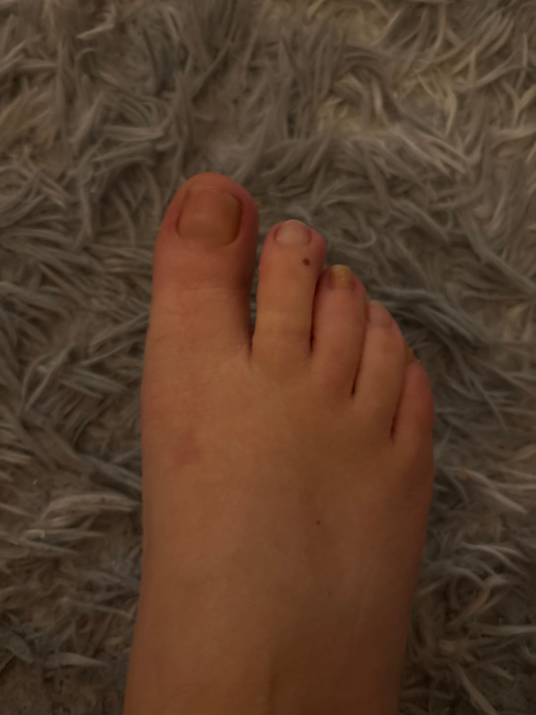 Customer photo review of Fungal Freedom