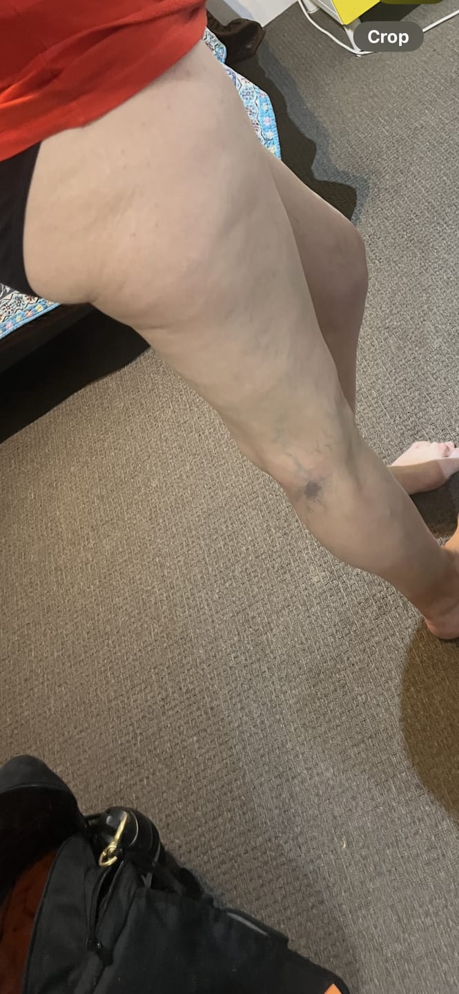 Customer photo review of Contour High Waisted Bike Shorts