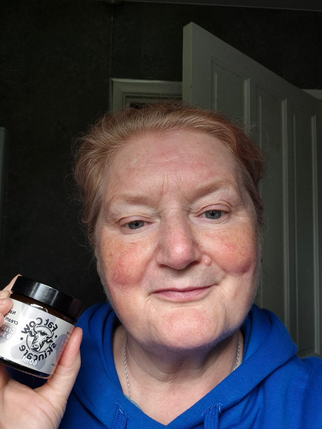 Customer photo review of Gentle Bundle | Face Cream & Tallow Soap