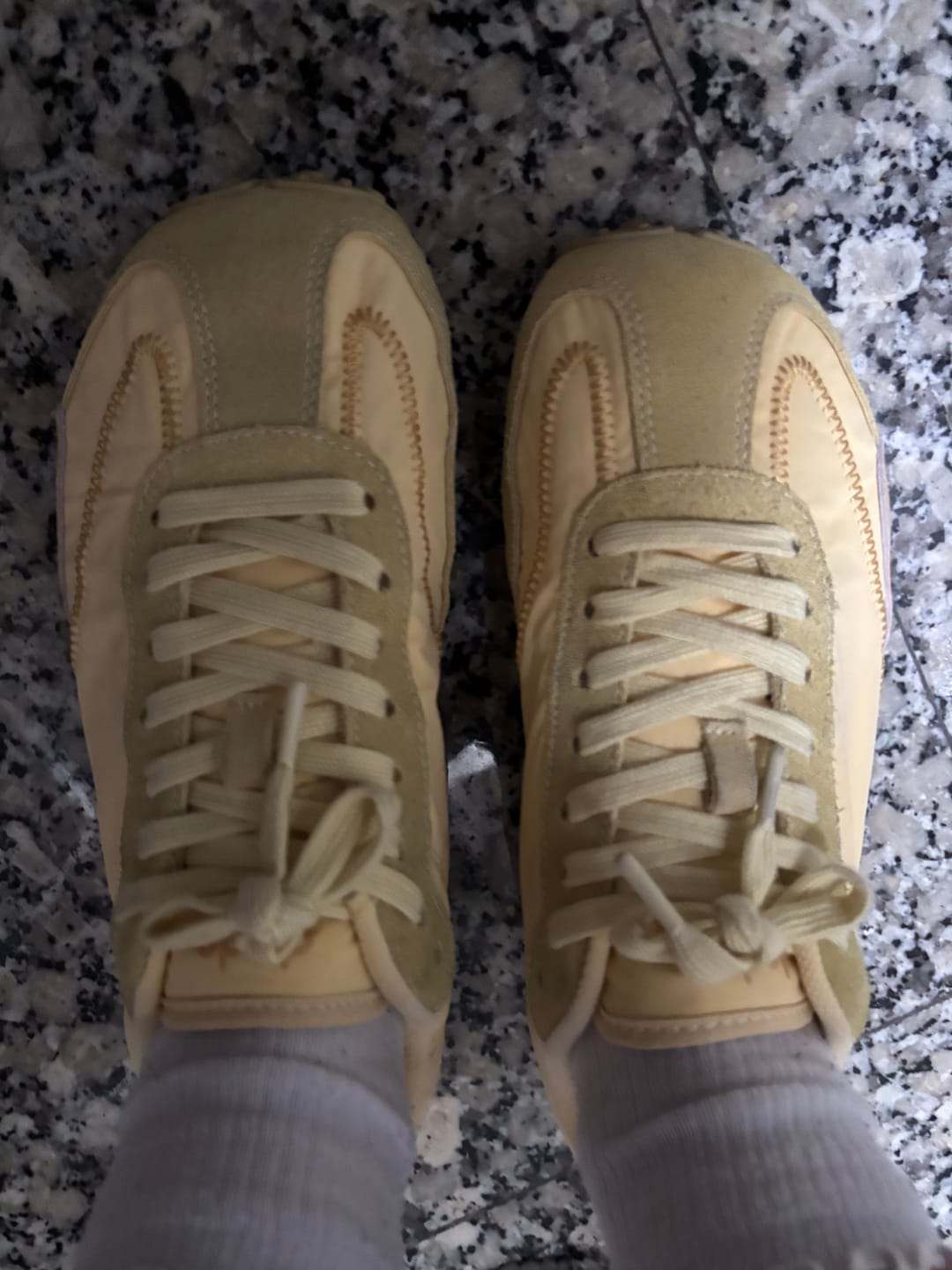 Customer photo review of ZERO YELLOW