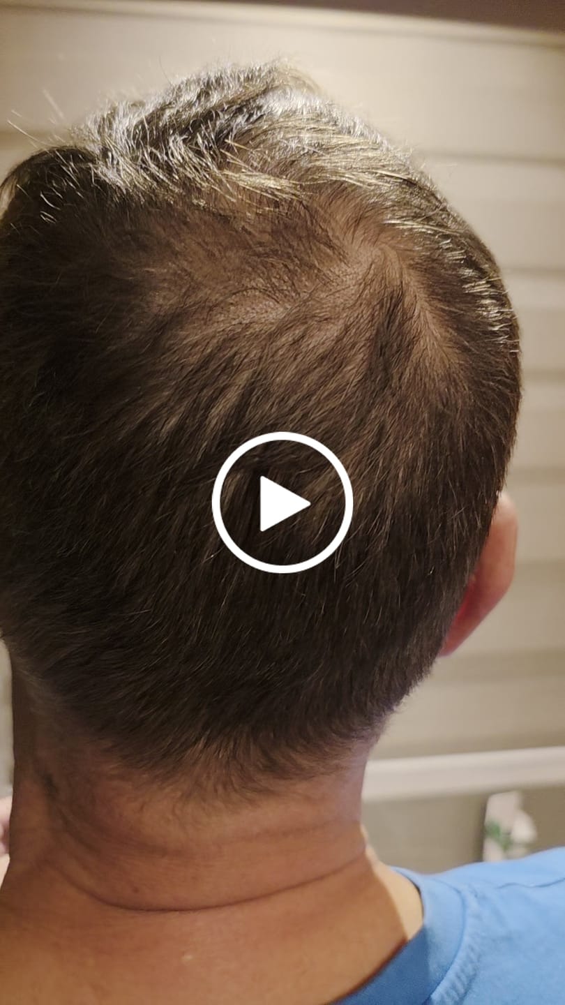 Customer video review of SÉRUM NATUREL AU ROMARIN — LE SOIN CIBLÉ QUI AGIT PENDANT DES HEURES