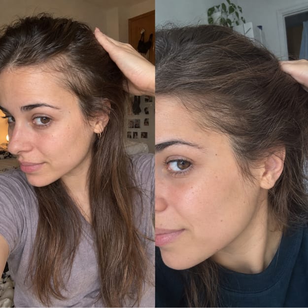 Customer photo review of KosmaHair Sérum | Restaurador Capilar & Entradas