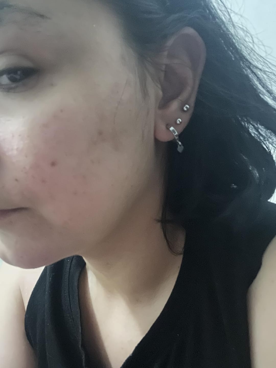 Customer photo review of Exosome & Niacinamide Serum for Radiant, Smoother-Looking Skin