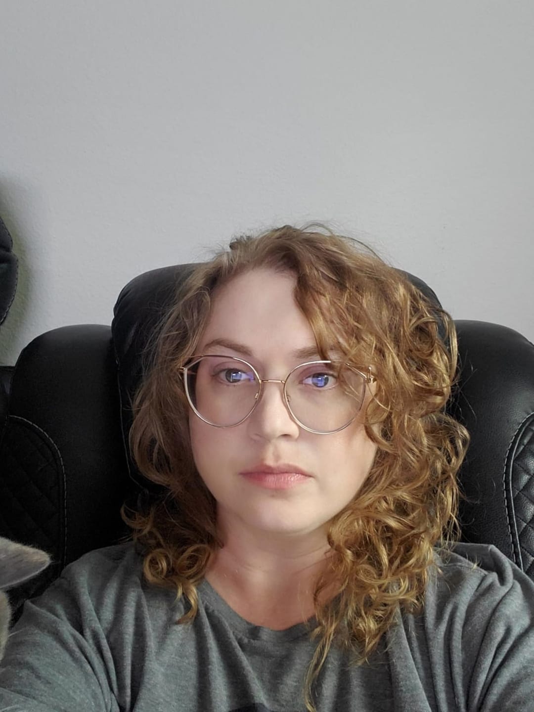 Customer photo review of Exosome & Niacinamide Serum for Radiant, Smoother-Looking Skin