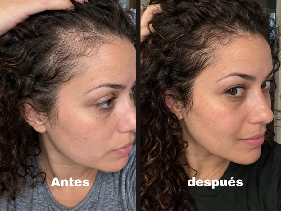 Customer photo review of KosmaHair Sérum | Restaurador Capilar & Entradas
