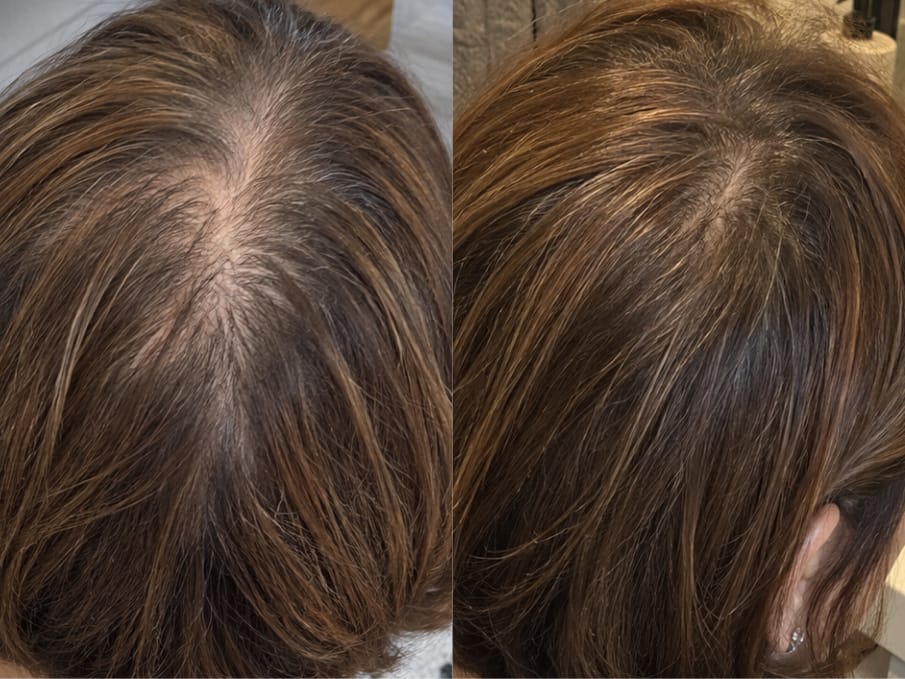 Customer photo review of KosmaHair Sérum | Restaurador Capilar & Entradas