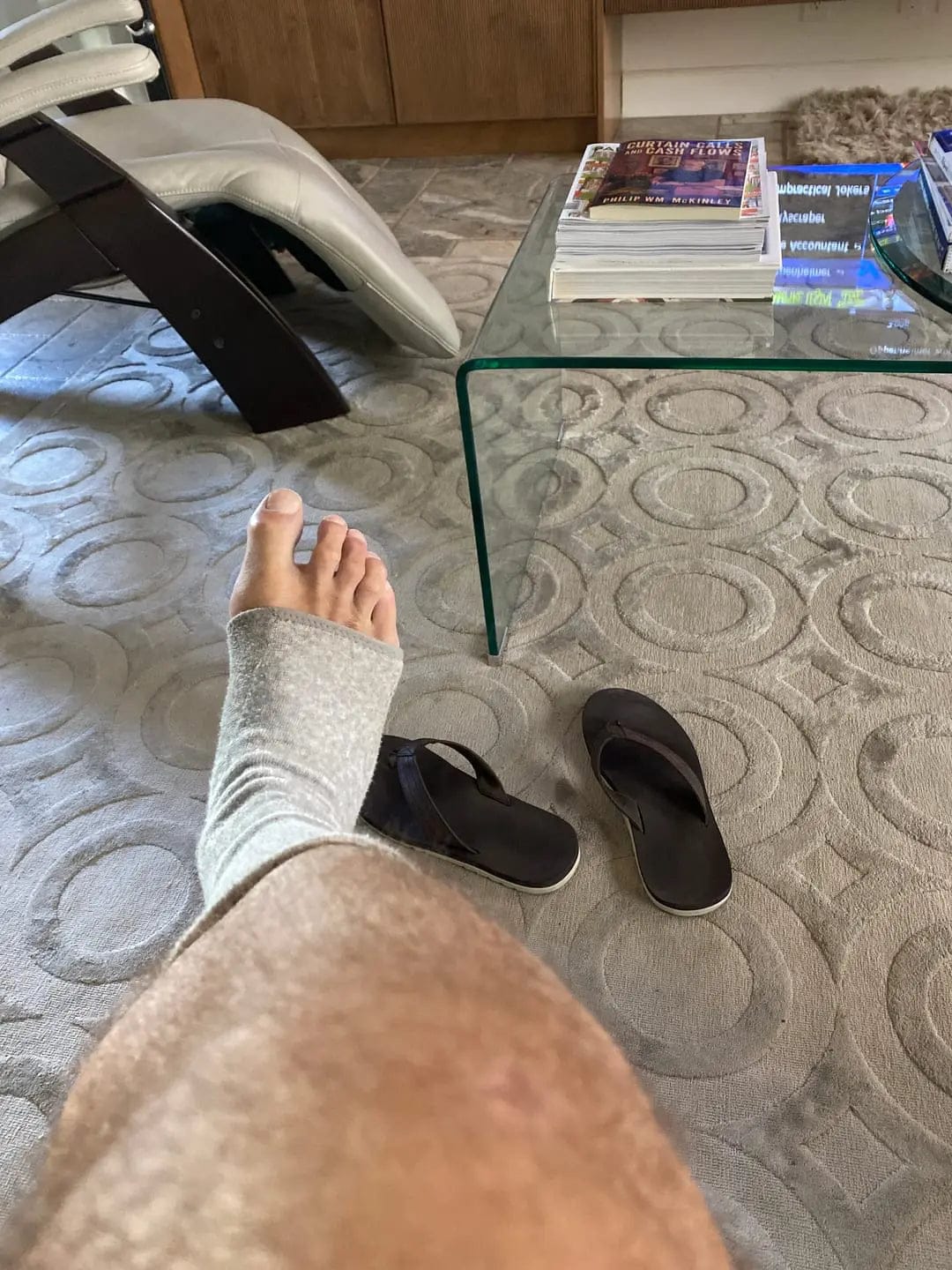Customer photo review of Piedelya™ – Manchons de compression pour les pieds