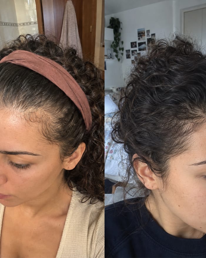 Customer photo review of KosmaHair Sérum | Restaurador Capilar & Entradas
