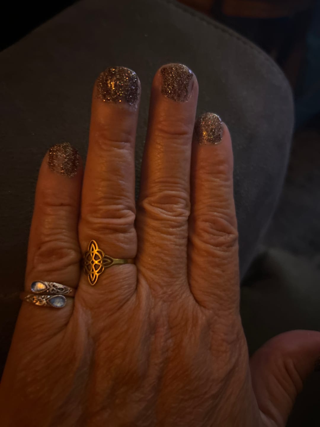 Customer photo review of Nagelriemverzachter (cadeau)