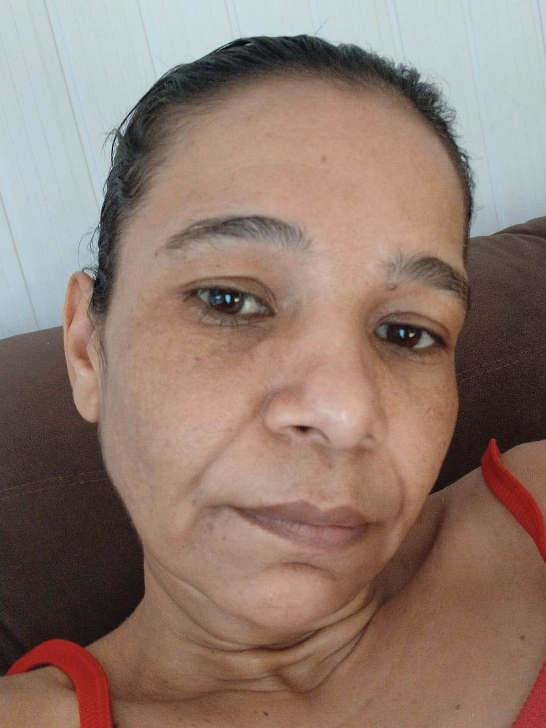Customer photo review of Creme Clareador de Manchas – Melasma, Axilas, Virilha, Áreas Íntimas, Rosto e Corpo