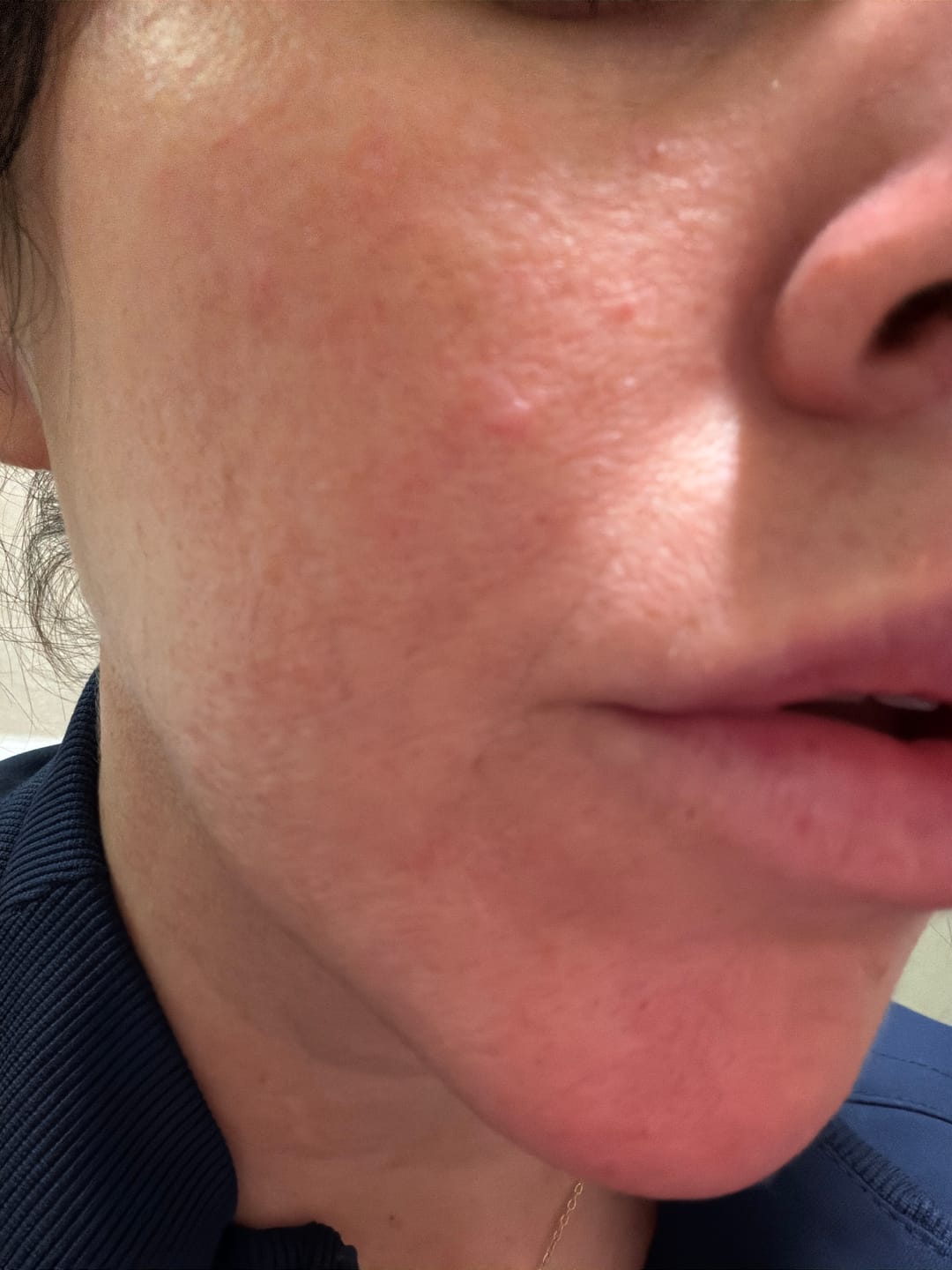 Customer photo review of LAVISH CREAM | RICH HYDRATION