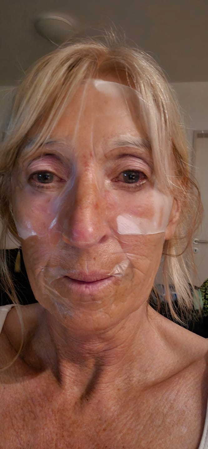 Customer photo review of Kollagen Boosting Maske
