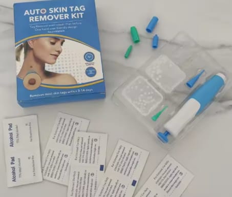 Customer photo review of Removedor de verrugas sin dolor