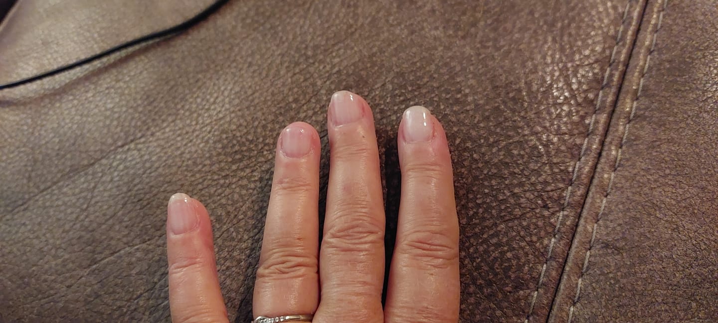 Customer photo review of Glowdip Alles-in-één Manicure Set