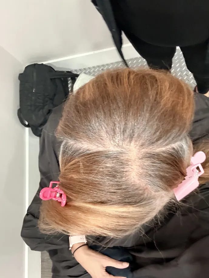 Customer photo review of Origin Labs™ - Women's Hair Growth Serum