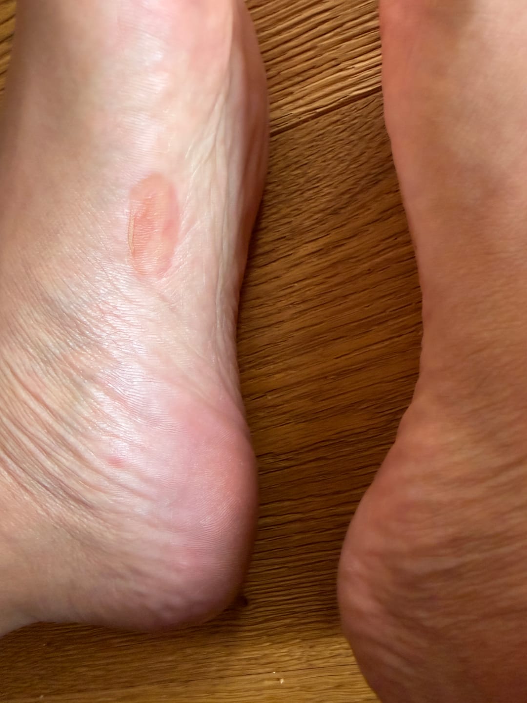 Customer photo review of Running insoles