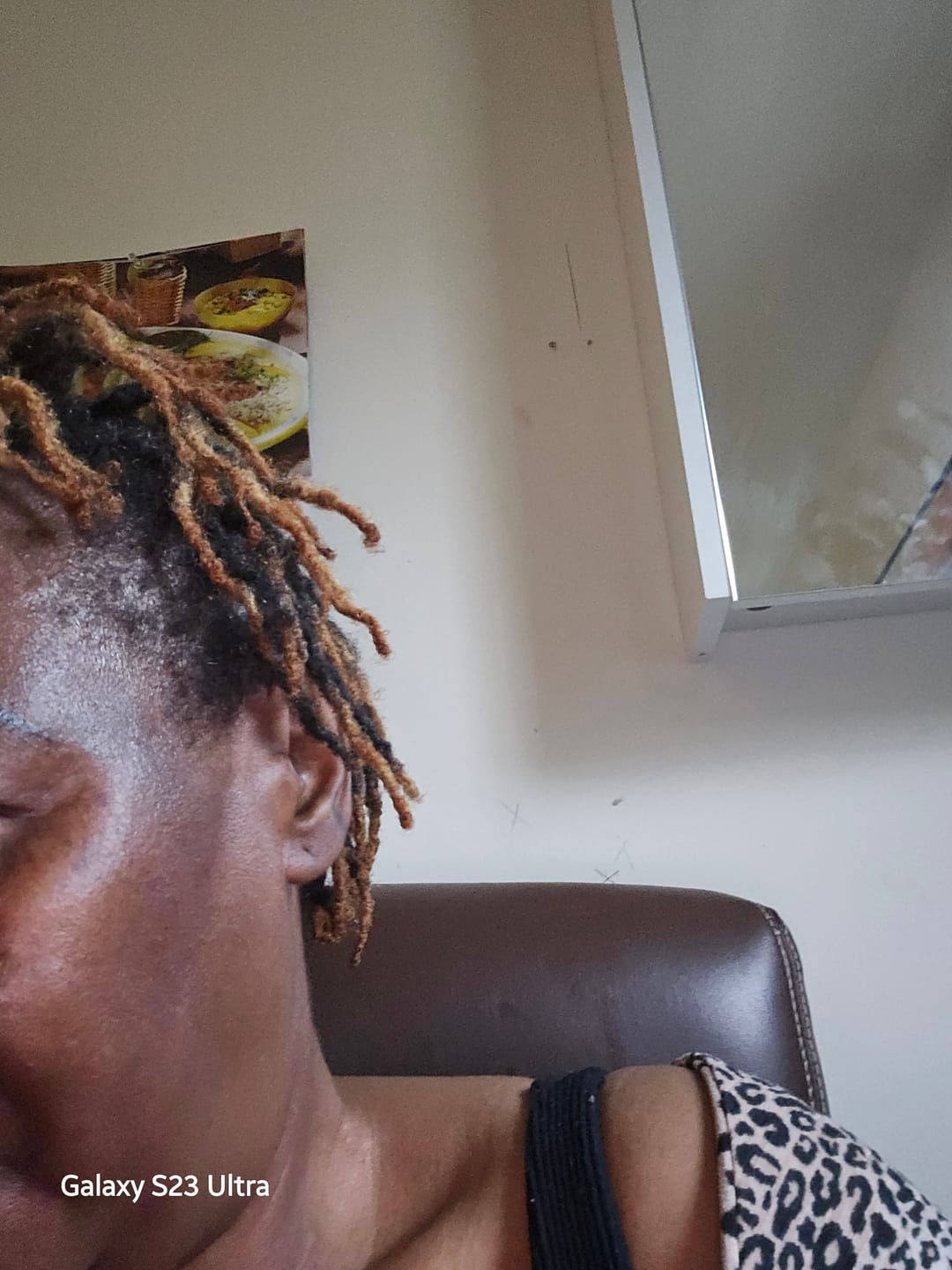 Customer photo review of NEW Redness and Burn Face Cream