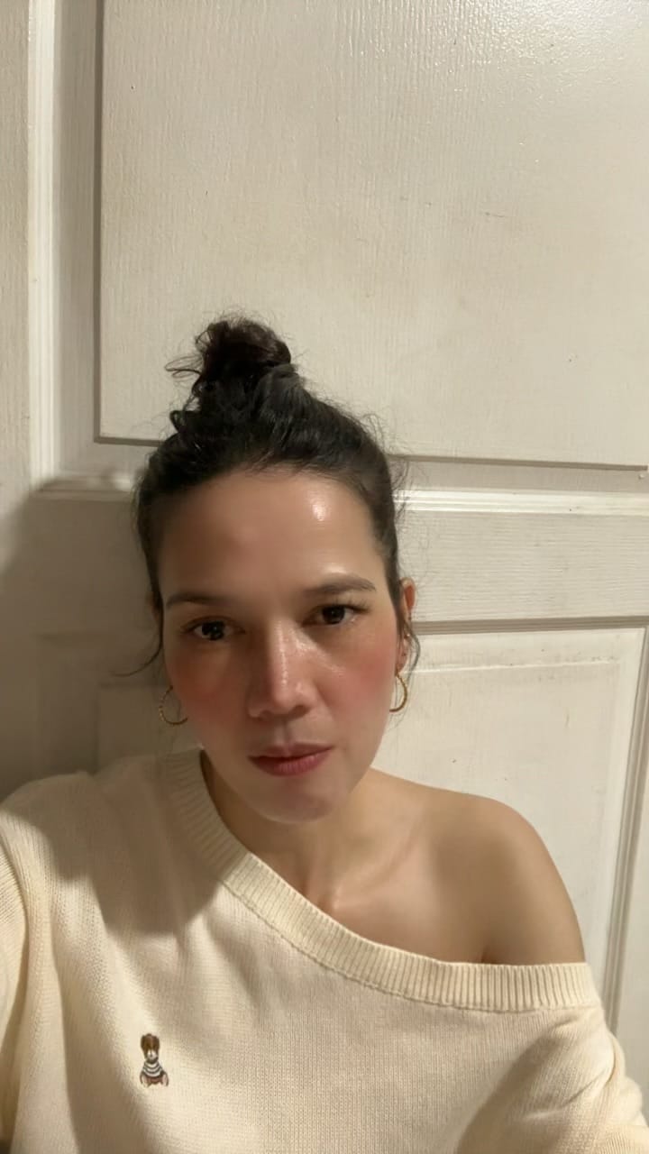 Customer photo review of Aejung™ Collagen Bomb Hydrating Ampoule