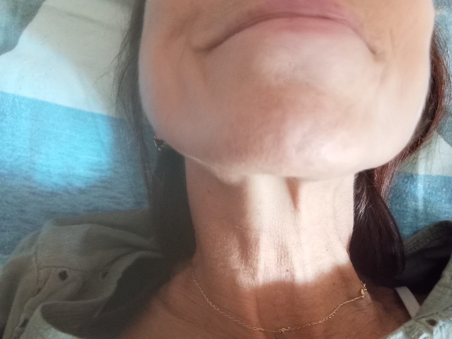 Customer photo review of RadicePura - Elimina i peli in eccesso