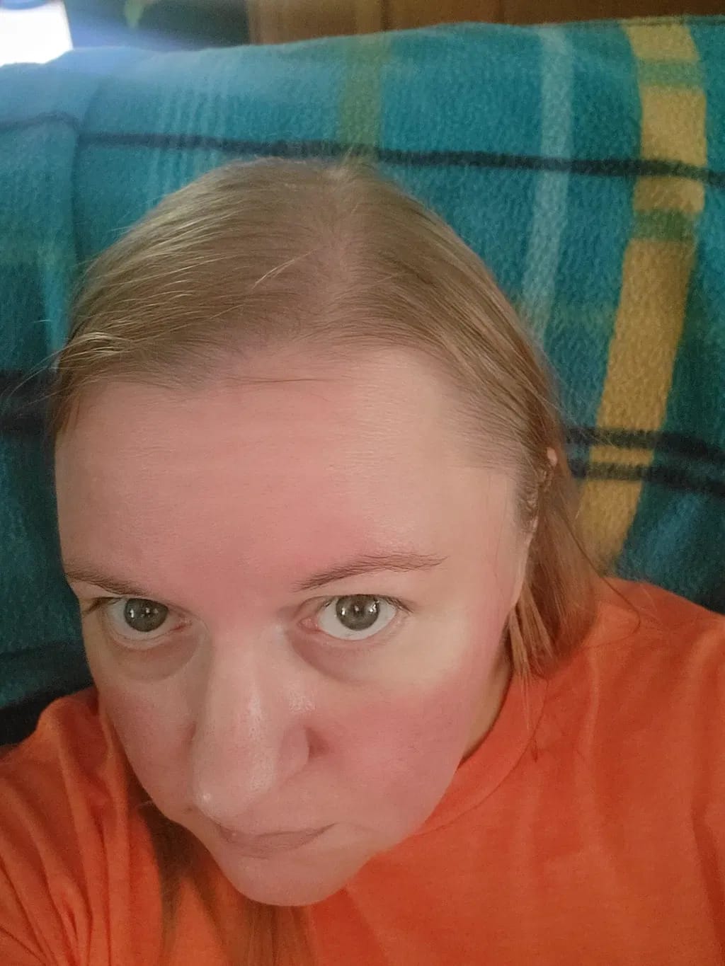 Customer photo review of Origin Labs™ - Women's Hair Growth Serum