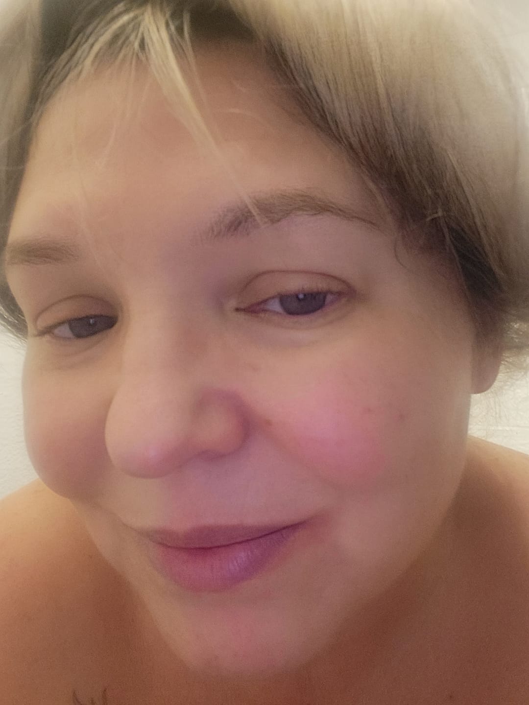 Customer photo review of Acide Hyaluronique - 1 mois