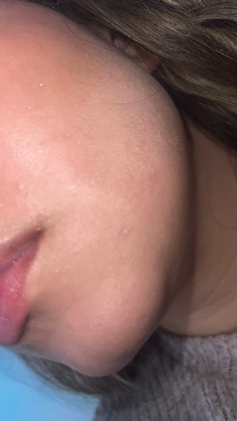 Customer photo review of GUMMY PRIMER
