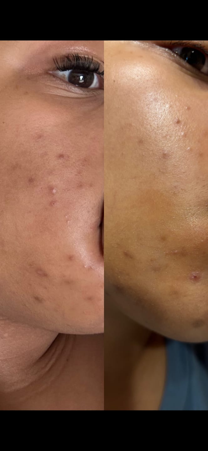Customer photo review of Turmeric Duo Bundle