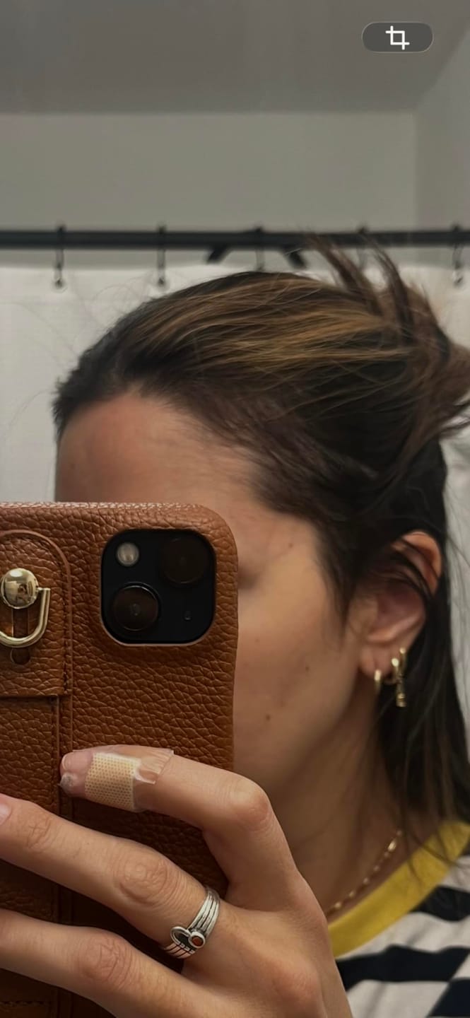 Customer photo review of Origin Labs™ - Women's Hair Growth Serum