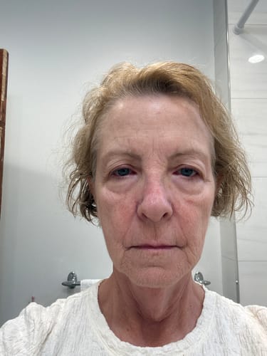 Reviewer's face, showing skin texture and tone in a home setting.