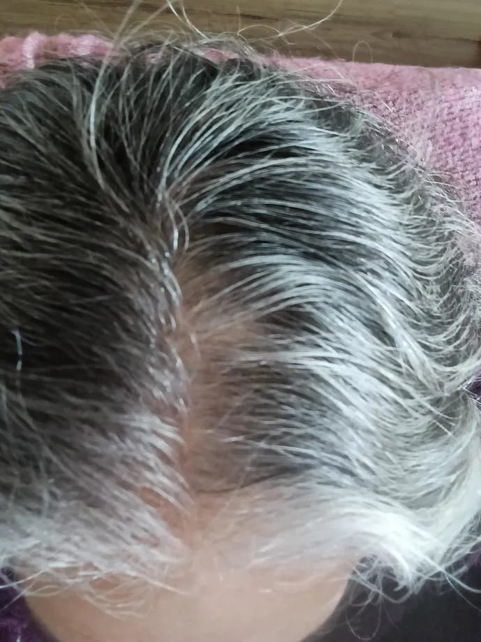 Customer photo review of Origin Labs™ - Women's Hair Growth Serum