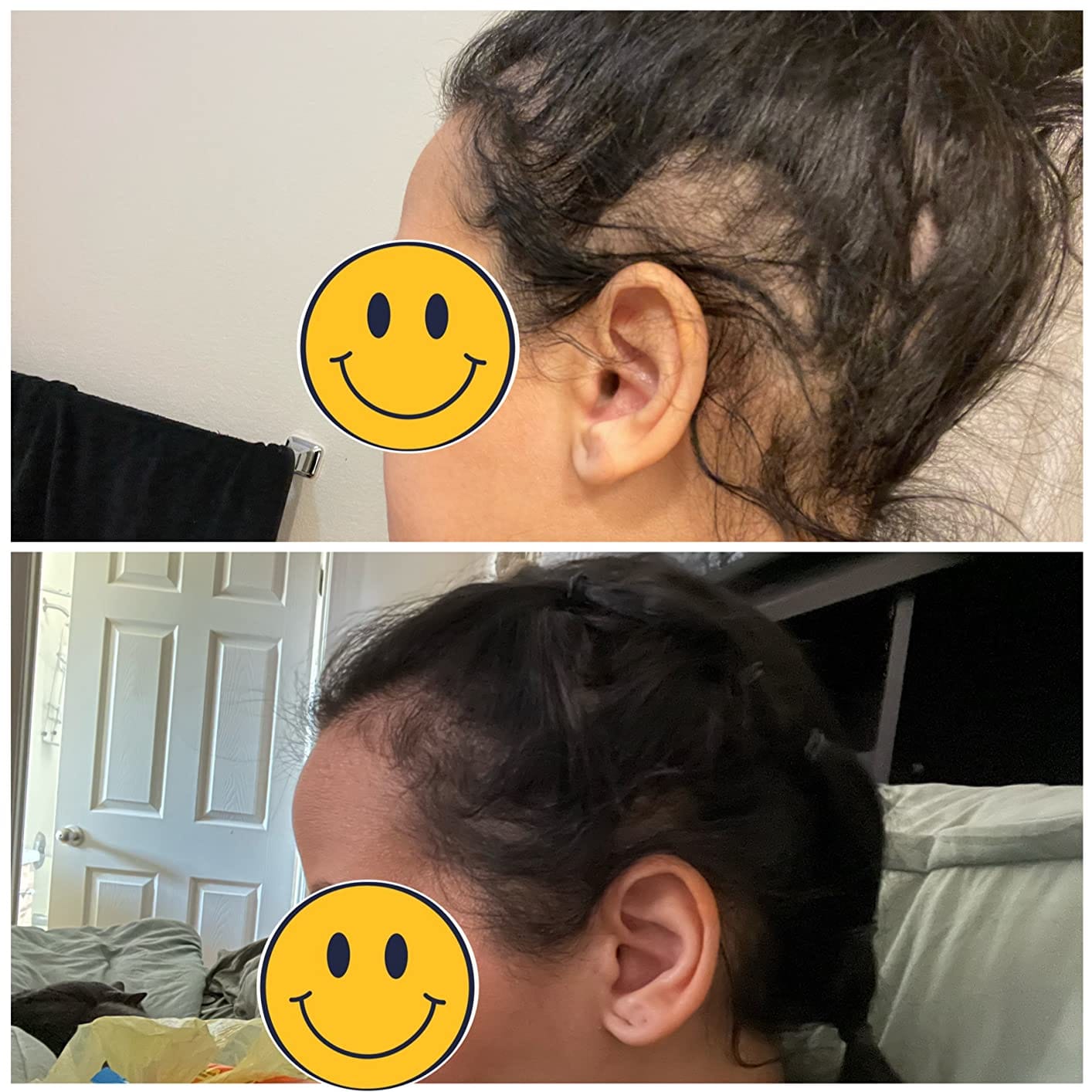 Customer photo review of Origin Labs™ - Women's Hair Growth Serum