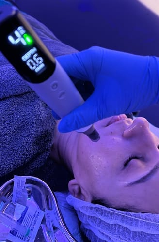 Customer photo review of Dr. Pen M9 Microneedling Pen